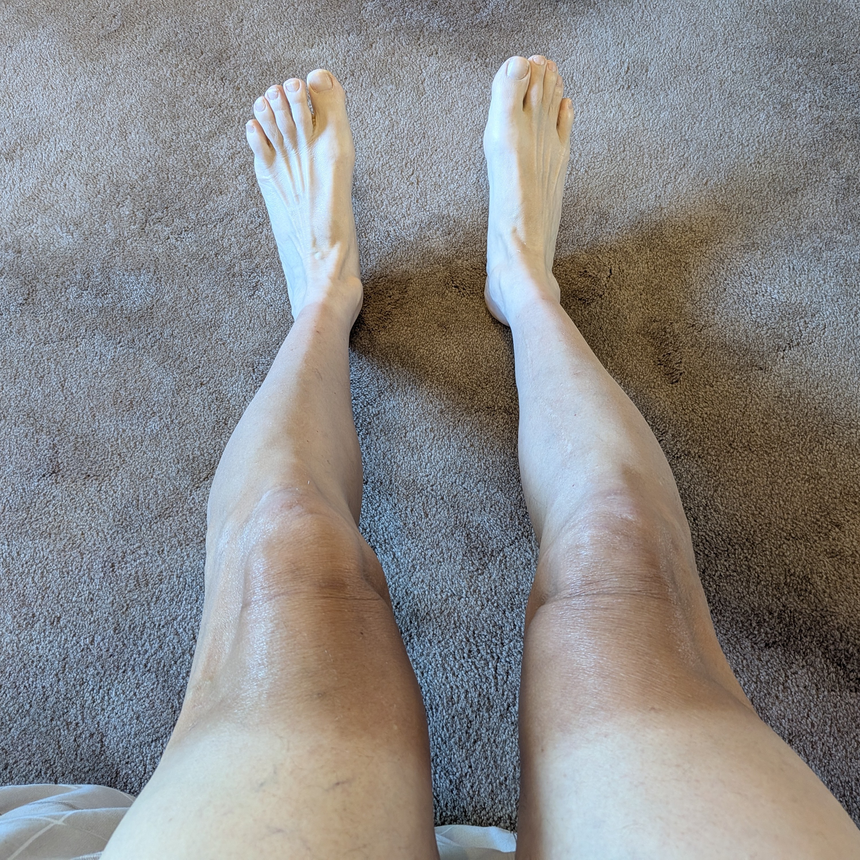 man's legs with typical bicyclist's tan: dark knees, white thighs